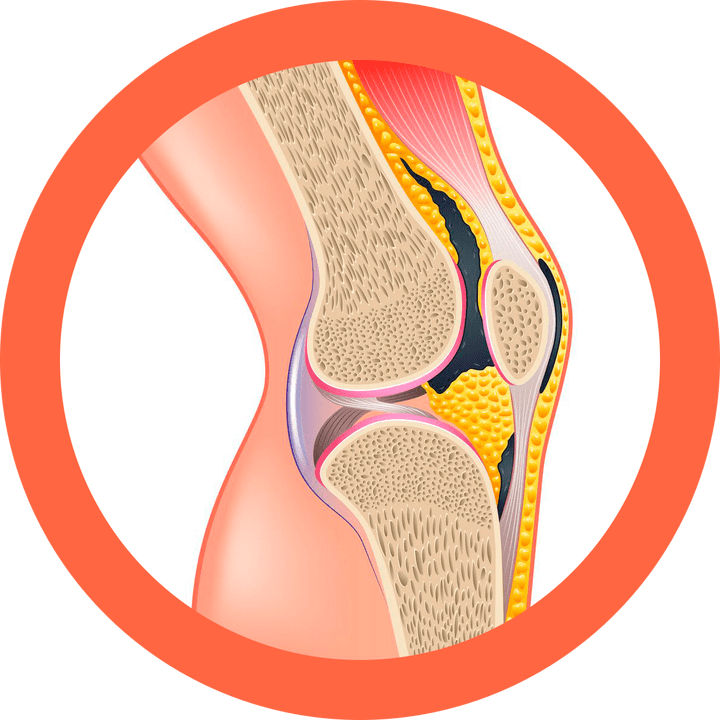 Hondroten - obnavlja zglobove i mišiće