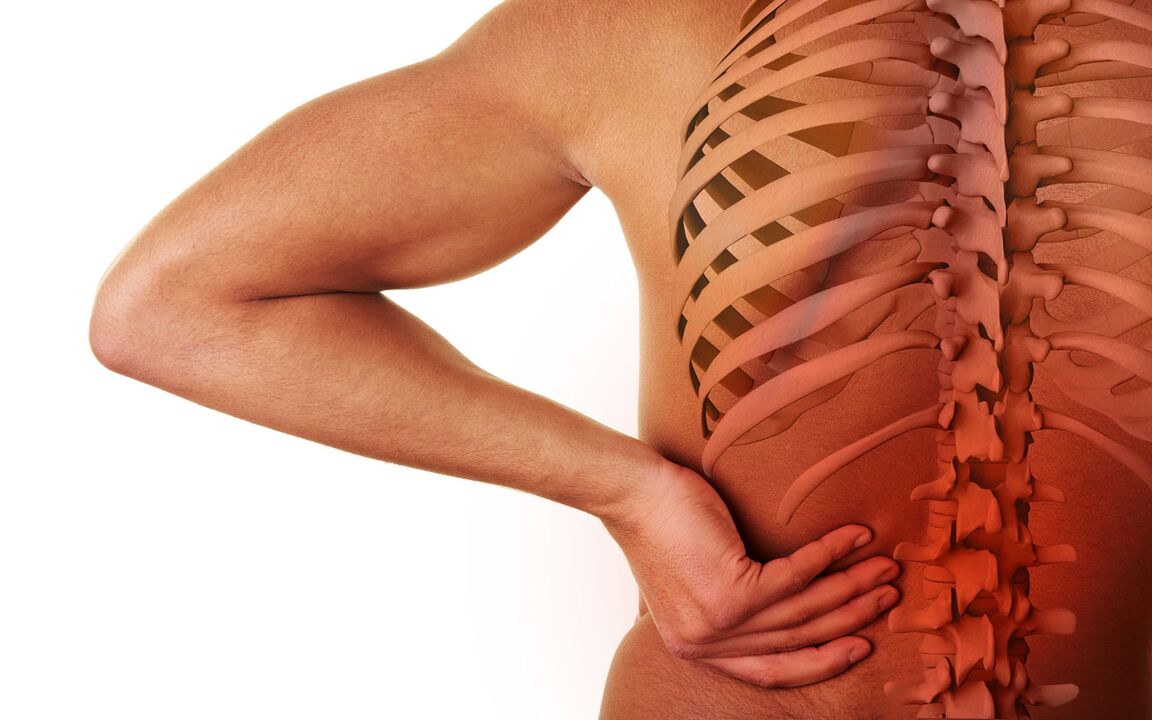 simptomi lumbalne osteohondroze