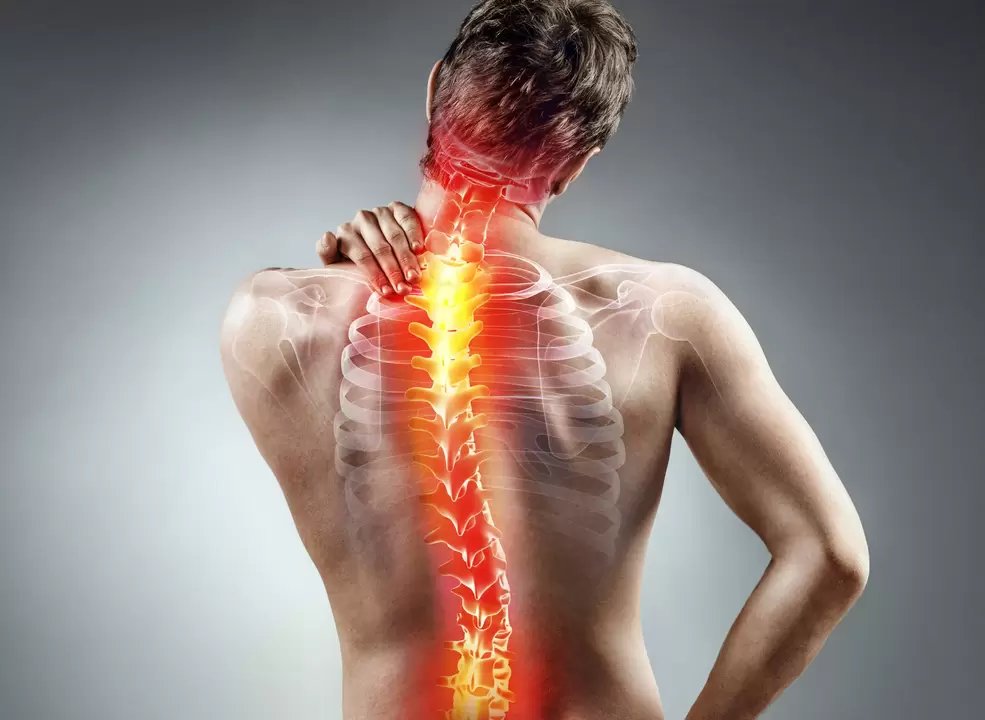 osteohondroza kralježnice